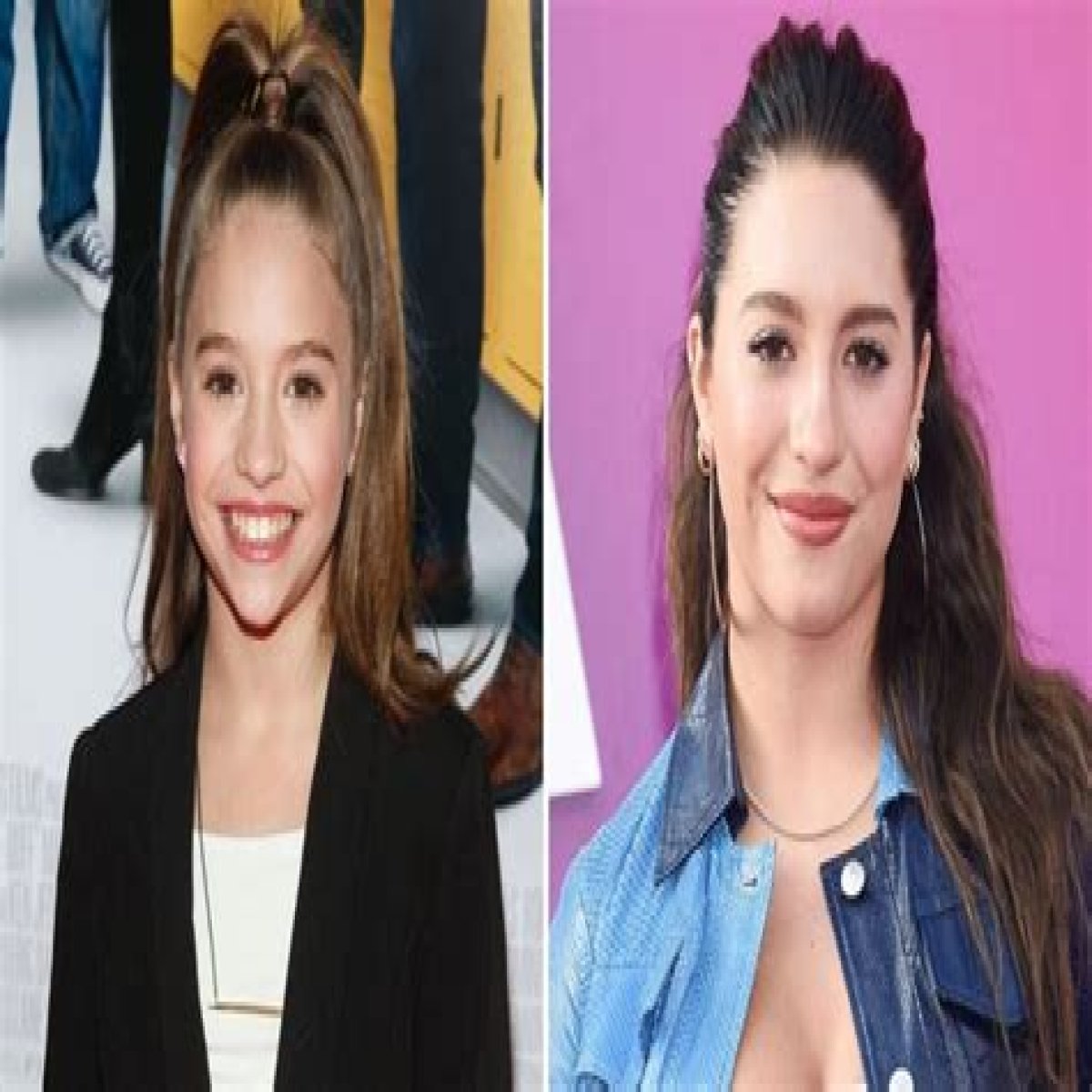 Mackenzie Ziegler Nose Job Botox And Lip Filler Before And After Photos
